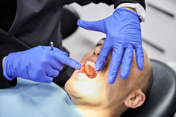Best Broken or Cracked Tooth Emergency Dentist in Cedar Mill, OR